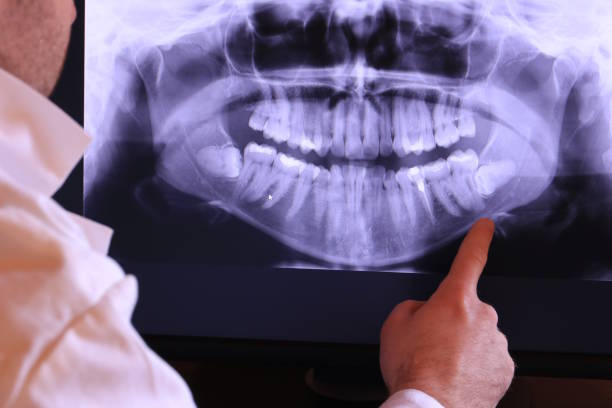 Best Urgent Care for Lost Fillings or Crowns in Pickens, MS